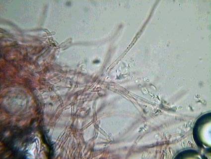 Hydnocystis piligera.